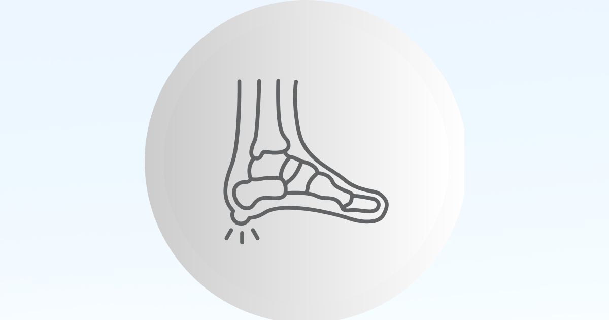 아침 첫 발 디딜 때 발바닥이 아픈 이유(족저근막 통증), 아침 발바닥 통증